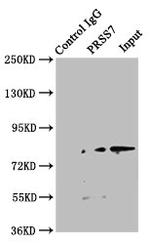 TMPRSS15 Antibody in Immunoprecipitation (IP)