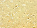PCDH19 Antibody in Immunohistochemistry (Paraffin) (IHC (P))