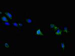 TRPM6 Polyclonal Antibody
