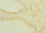 TRPM6 Antibody in Immunohistochemistry (Paraffin) (IHC (P))