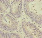 MCCC1 Polyclonal Antibody