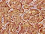 LATS1 Antibody in Immunohistochemistry (Paraffin) (IHC (P))