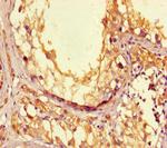 LPAL2 Antibody in Immunohistochemistry (Paraffin) (IHC (P))