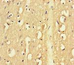 FAM46C Antibody in Immunohistochemistry (Paraffin) (IHC (P))