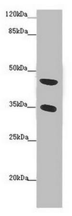 FAM46C Antibody in Western Blot (WB)