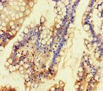 TALK-1 Polyclonal Antibody