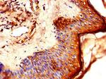 LCE1B Antibody in Immunohistochemistry (Paraffin) (IHC (P))