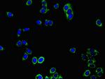 PRDX3 Polyclonal Antibody
