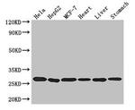 PRDX3 Antibody in Western Blot (WB)