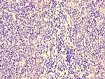 HCP5 Antibody in Immunohistochemistry (Paraffin) (IHC (P))