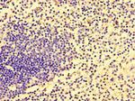HCP5 Antibody in Immunohistochemistry (Paraffin) (IHC (P))
