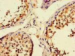 UNC13C Antibody in Immunohistochemistry (Paraffin) (IHC (P))