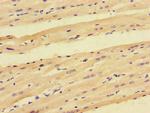 PPP1R12C Antibody in Immunohistochemistry (Paraffin) (IHC (P))