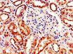 TDRD12 Polyclonal Antibody