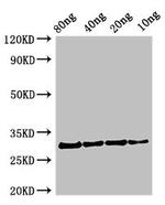 Profilin 1 Polyclonal Antibody