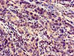 LOXHD1 Antibody in Immunohistochemistry (Paraffin) (IHC (P))
