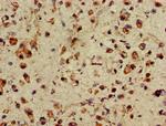 ASH1 Antibody in Immunohistochemistry (Paraffin) (IHC (P))