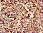 ASH1 Antibody in Immunohistochemistry (Paraffin) (IHC (P))