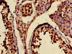 KIF20A Antibody in Immunohistochemistry (Paraffin) (IHC (P))