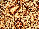 GSX1 Antibody in Immunohistochemistry (Paraffin) (IHC (P))