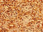 GSX1 Antibody in Immunohistochemistry (Paraffin) (IHC (P))
