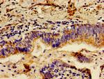 LCT Polyclonal Antibody