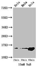 Acetyl-HIST1H2AG (Lys5) Antibody in Western Blot (WB)