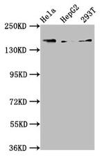 Complement C4 Antibody in Western Blot (WB)