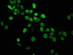 H4K5me1 Polyclonal Antibody