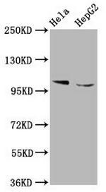 IKAP Antibody in Western Blot (WB)