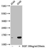 Phospho-HIST1H2BC (Ser14) Antibody in Western Blot (WB)
