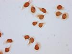 Acetyl-HIST1H2BC (Lys108) Polyclonal Antibody