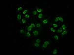 Acetyl-HIST1H2BC (Lys108) Antibody in Immunocytochemistry (ICC/IF)