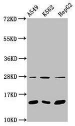 Mono-methyl-HIST1H2BC (Lys15) Antibody in Western Blot (WB)