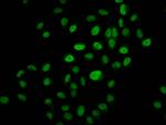 2-hydroxyisobutyryl-Histone H3 (Lys14) Antibody in Immunocytochemistry (ICC/IF)