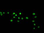 beta-hydroxybutyryl-HIST1H2BC (Lys120) Polyclonal Antibody