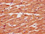 TMEM127 Antibody in Immunohistochemistry (Paraffin) (IHC (P))