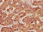 GATS Antibody in Immunohistochemistry (Paraffin) (IHC (P))