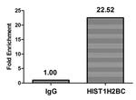 Acetyl-HIST1H2BC (Lys120) Antibody in ChIP Assay (ChIP)