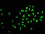 Acetyl-HIST1H2BC (Lys120) Antibody in Immunocytochemistry (ICC/IF)