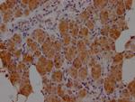 HTN3 Polyclonal Antibody