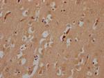 MYO15A Polyclonal Antibody