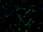 MYO15A Polyclonal Antibody