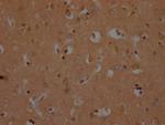 OR10A2 Polyclonal Antibody