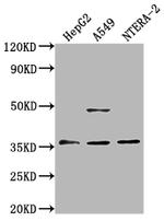 OR4D10 Antibody in Western Blot (WB)