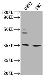 OR5K2 Polyclonal Antibody