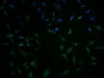 TBC1D3G Antibody in Immunocytochemistry (ICC/IF)
