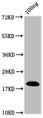 SARS-CoV-2 Nucleocapsid Antibody in Western Blot (WB)