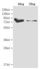 iutA Polyclonal Antibody