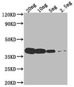 VCATH Polyclonal Antibody